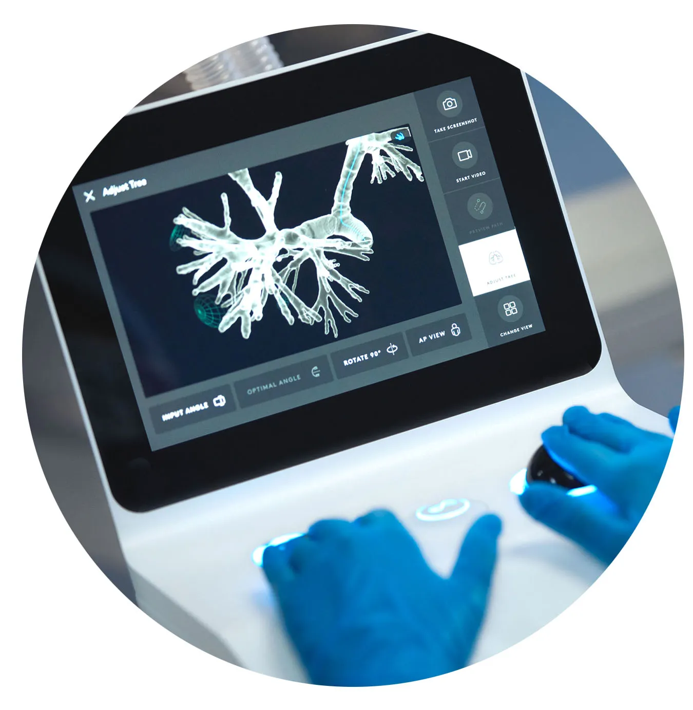 ION Robotic Surgery.jpg